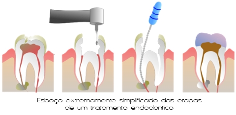 Endodontia