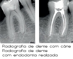 Endodontia