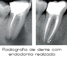 Endodontia