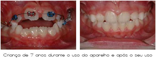 Ortodontia