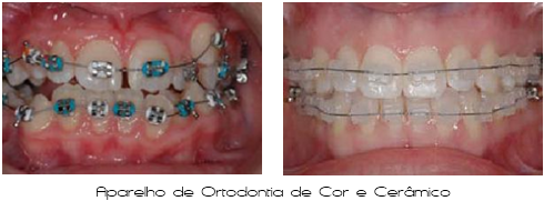 Ortodontia