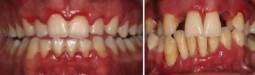 Periodontologia
